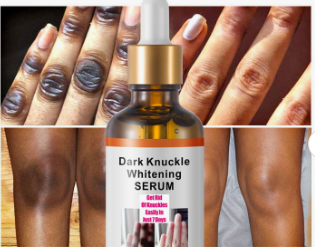 Sérum Éclaircissant Anti-Taches - Articulations Mains Coudes Genoux 30ml