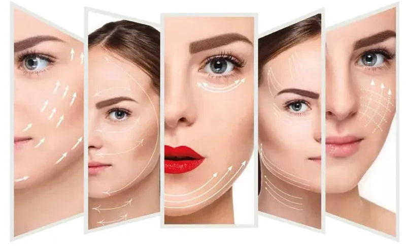 Lifting du visage, réduction du double menton